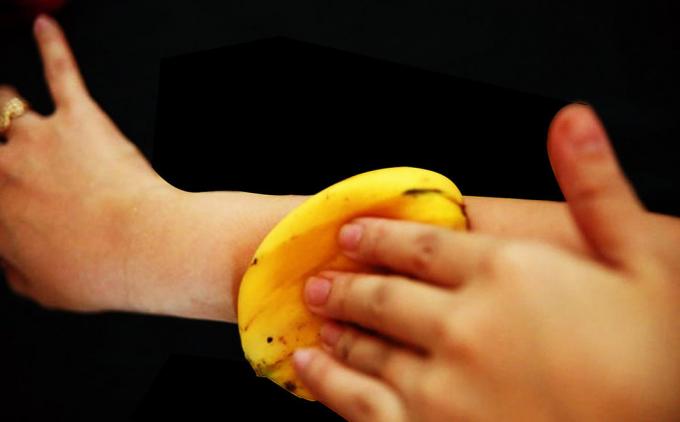 Banana Haut lindert Juckreiz perfekt vor Mückenstichen