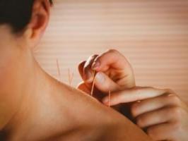 Die Akupunktur ist nützlich, und dass sie behandelt werden